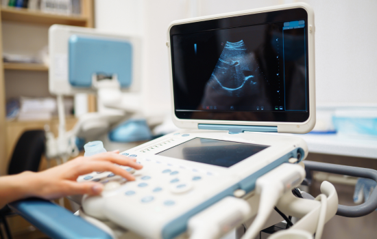 3D Sonography