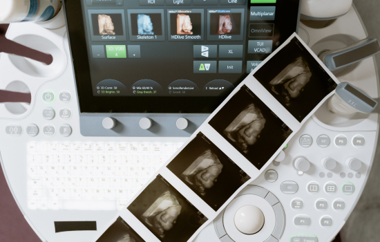  Sonography